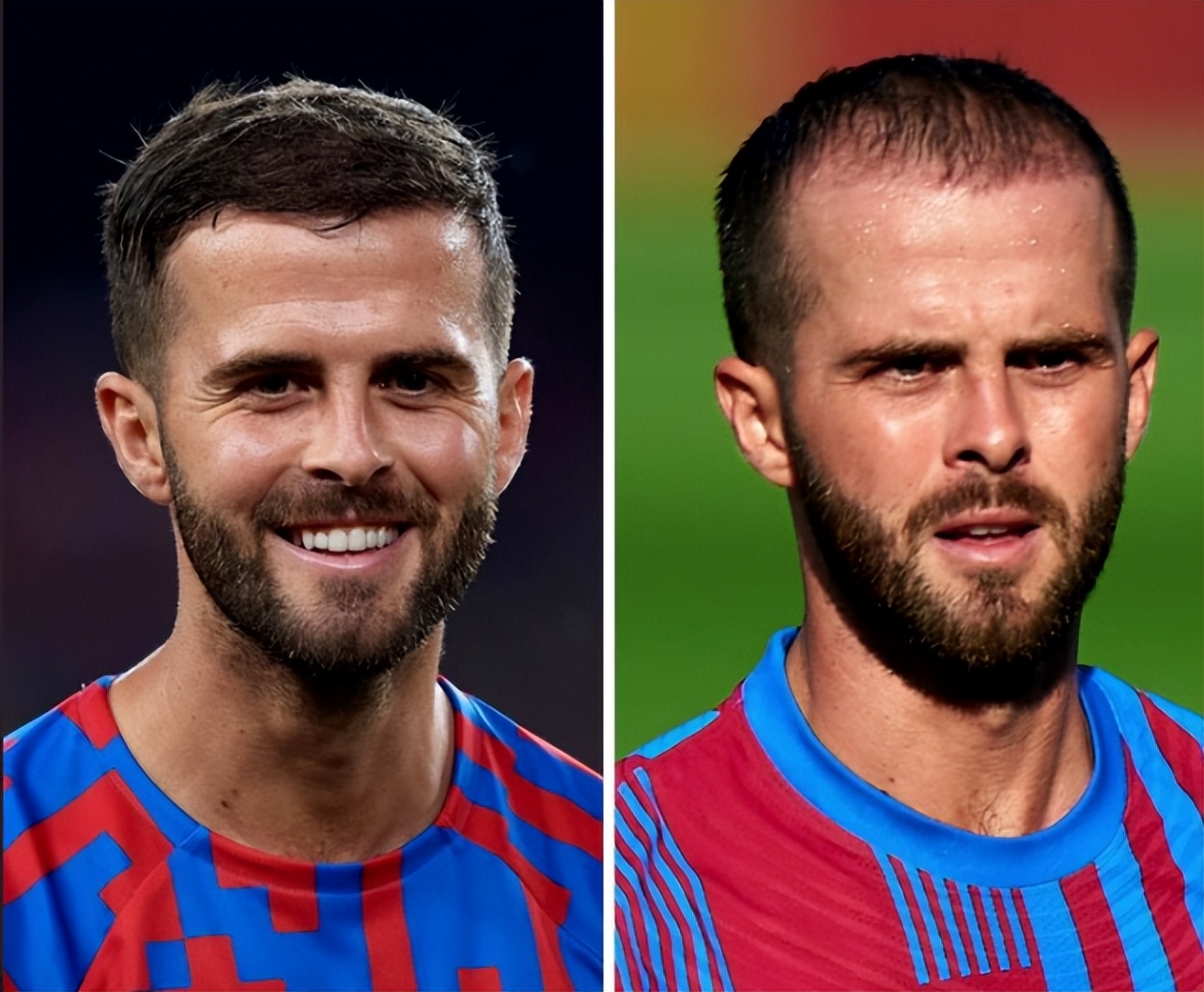 植发行业跟整形医美行业哪个更好,世界杯球星美容