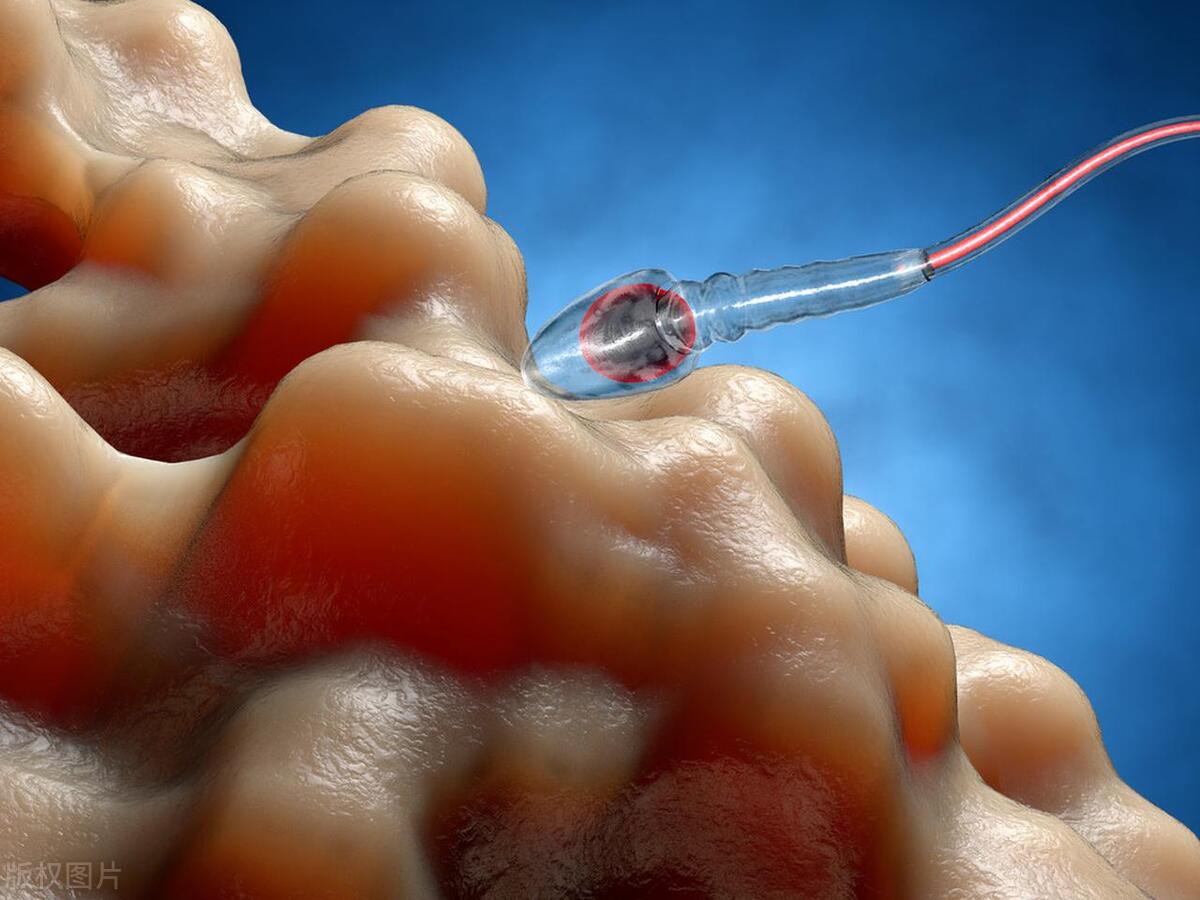 精子畸形率96.7%可以试管么,精子畸形率96染色体会异常吗