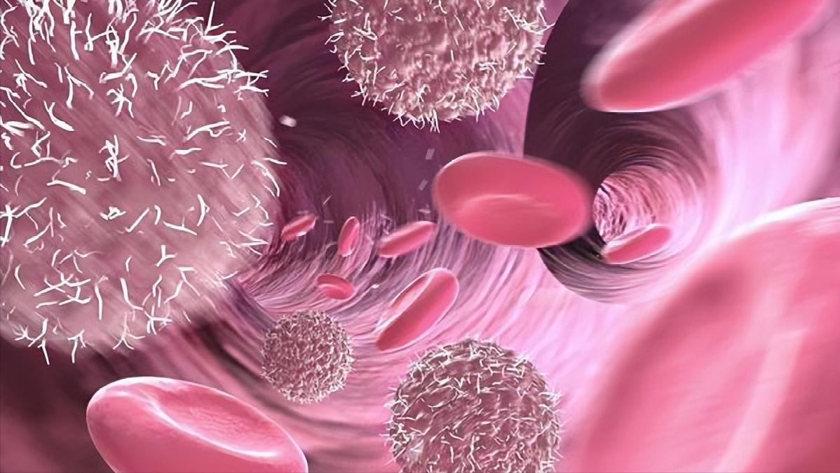 感染了hpv一定会得宫颈癌吗,宫颈癌早期10种症状做hpv多少钱