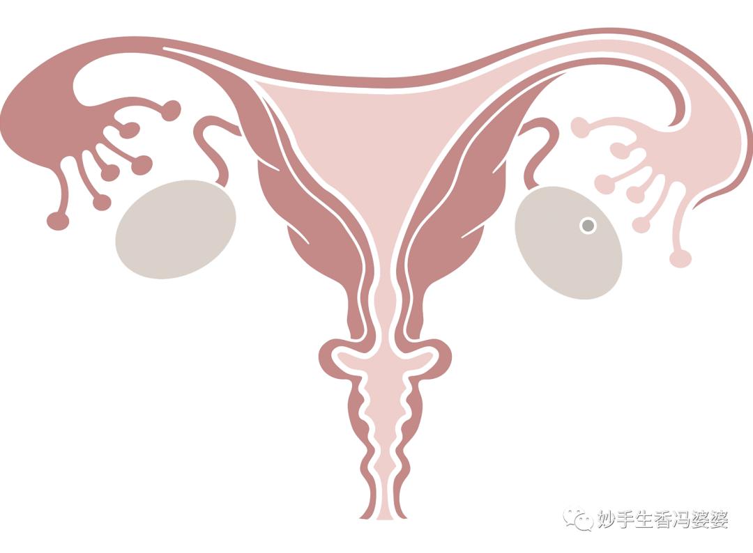 子宫畸形造成的胎停好治疗吗,子宫畸形是不是没法生孩子了