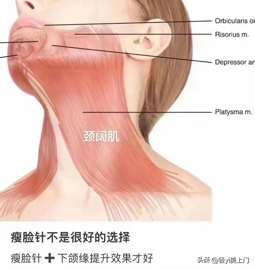 微整医美材料,医美微整注射图