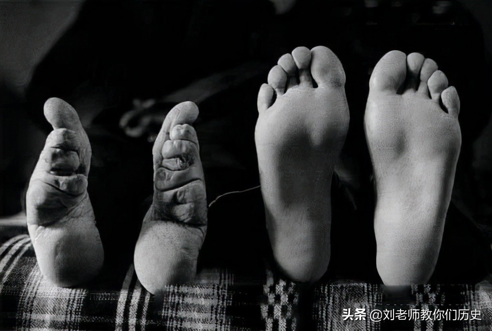 历史上什么朝代开始裹小脚,古代裹小脚的真实目的是什么