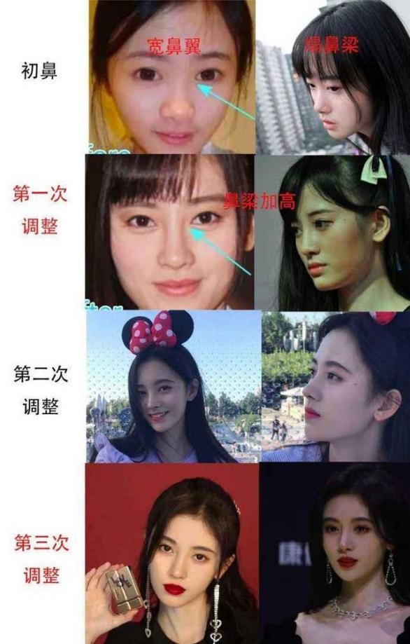 因整容毁掉前途的女星,整容改命的五位明星