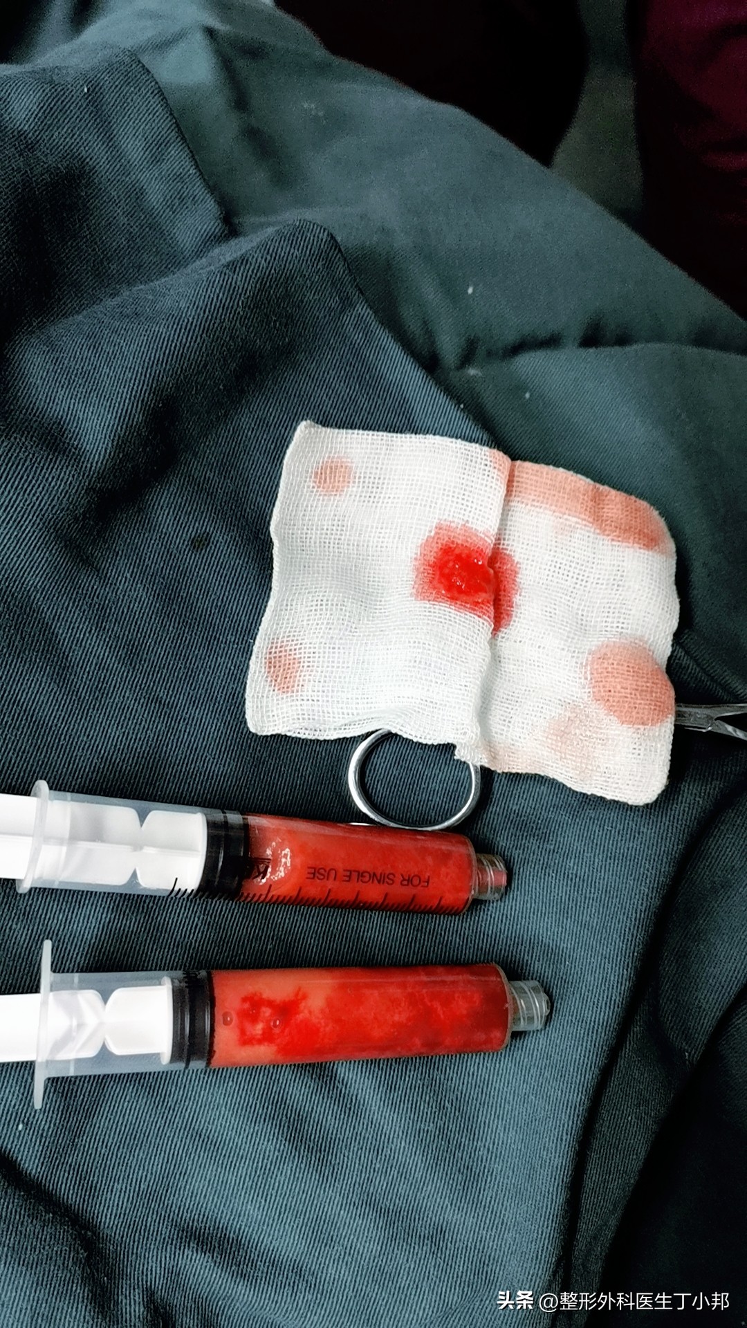 一个小姑娘毁容,一个女的毁容后才知道是救了自己