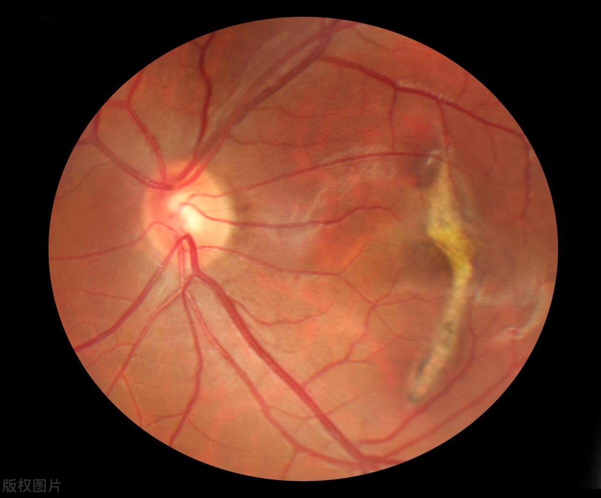 近视眼吃什么对眼睛好可以明目,吃什么食物能对眼睛近视有帮助