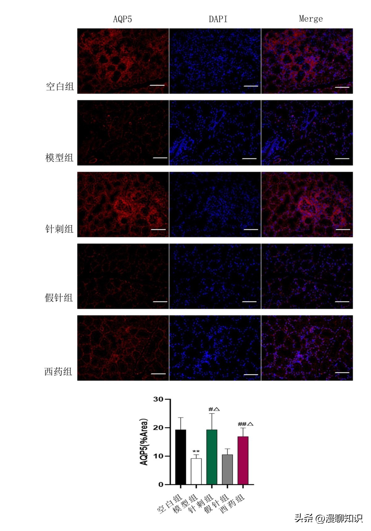 干眼病属于眼底病吗,干眼症状是怎么得来的