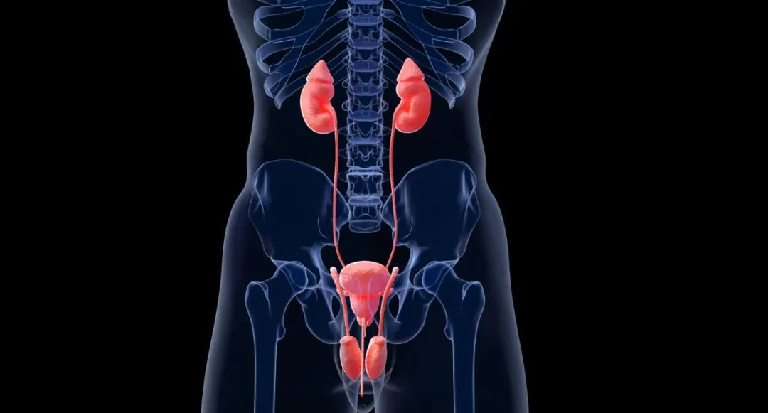 膀胱癌，两年内3次手术2次化疗，怎样才能彻底解决问题