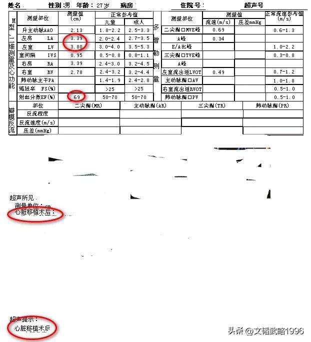 心肌致密化不全对心脏有哪些影响,心肌致密化不全多大能诊断