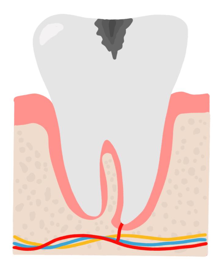 健康牙齿会晃动吗,健康牙齿松动怎么办