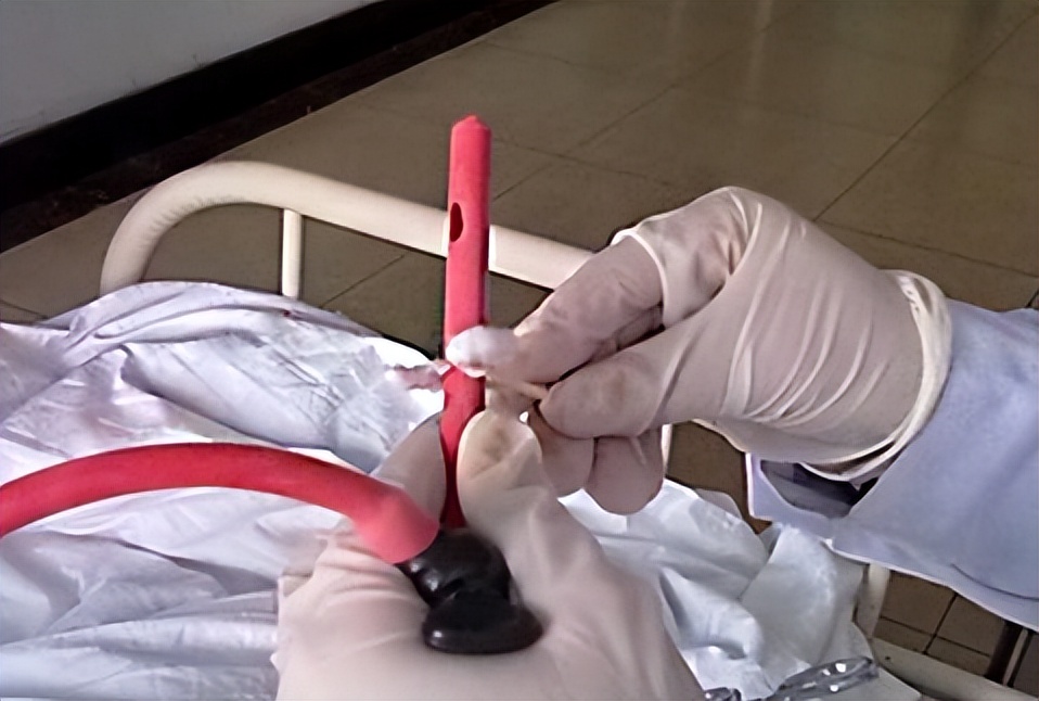 情侣间的“灌肠游戏”影响身体健康吗？听听医生怎么说