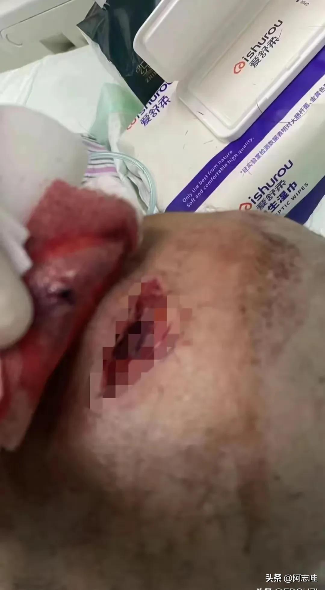 体罚打手心打到哭视频太惨了！长沙9岁女孩被男老师打得脑浆炸