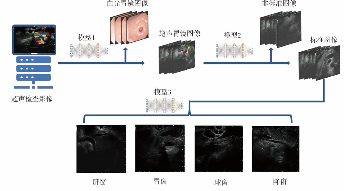 基于深度学习的内镜超声胆管扫查辅助分站系统构建