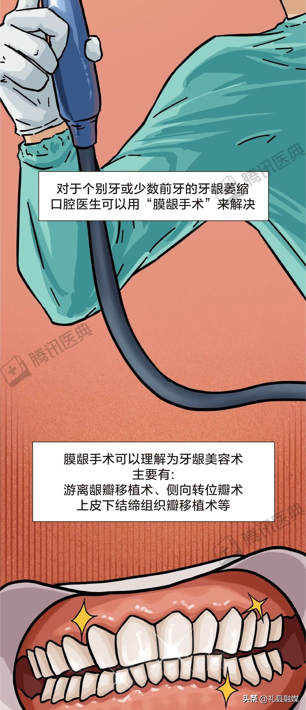 牙齿吃肉总是塞牙怎么治疗,吃肉吃菜老是塞牙怎么办