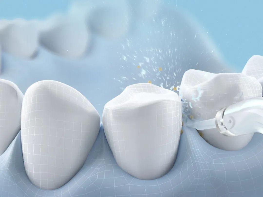 中秋节送领导客户礼物怎么选？5款冲牙器寓意爆火