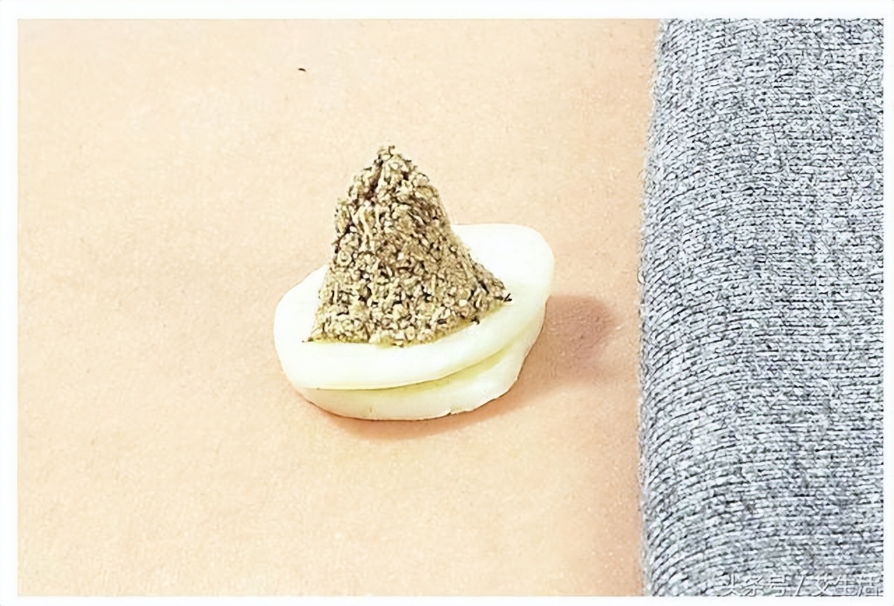 强直性脊柱炎健康科普,强直性脊柱炎用中医好还是西医好