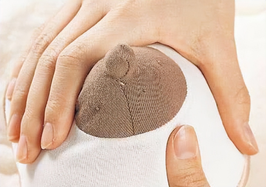 哺乳期乳晕内有个疙瘩是乳腺癌吗,乳圈周围有小疙瘩是乳腺癌吗