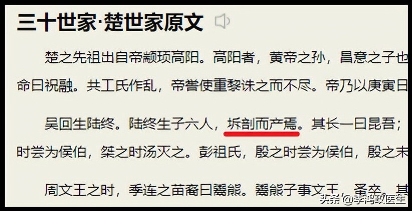 鍓栬吂浜х暀涓嬫墜鏈垁,鍓栬吂浜ч仐鐣欐墜鏈垁