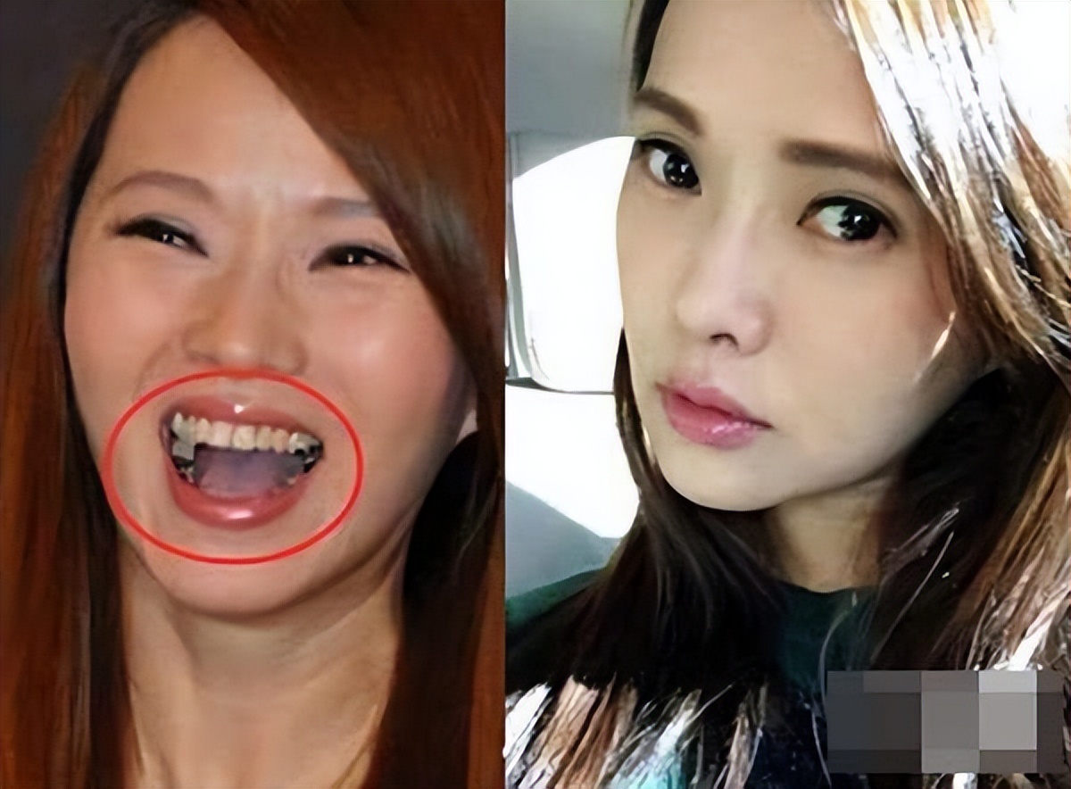 垫屁垫，烤瓷牙，戴美瞳：这些女明星的修修补补，看得人眼花缭乱