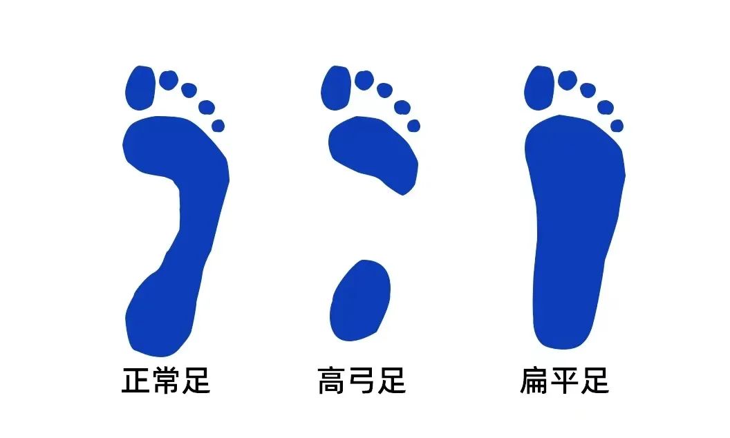 哪些品牌的童鞋雌激素高,雌激素超标童鞋