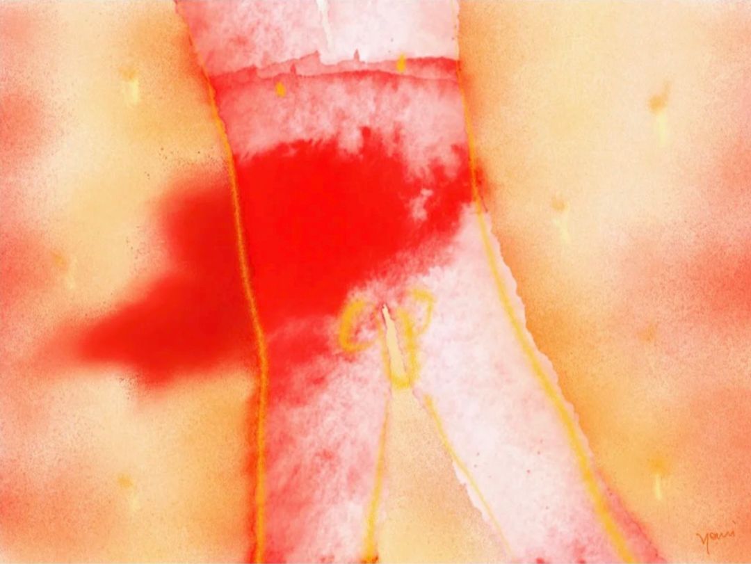 画下女性的身体和伤痕|青视觉