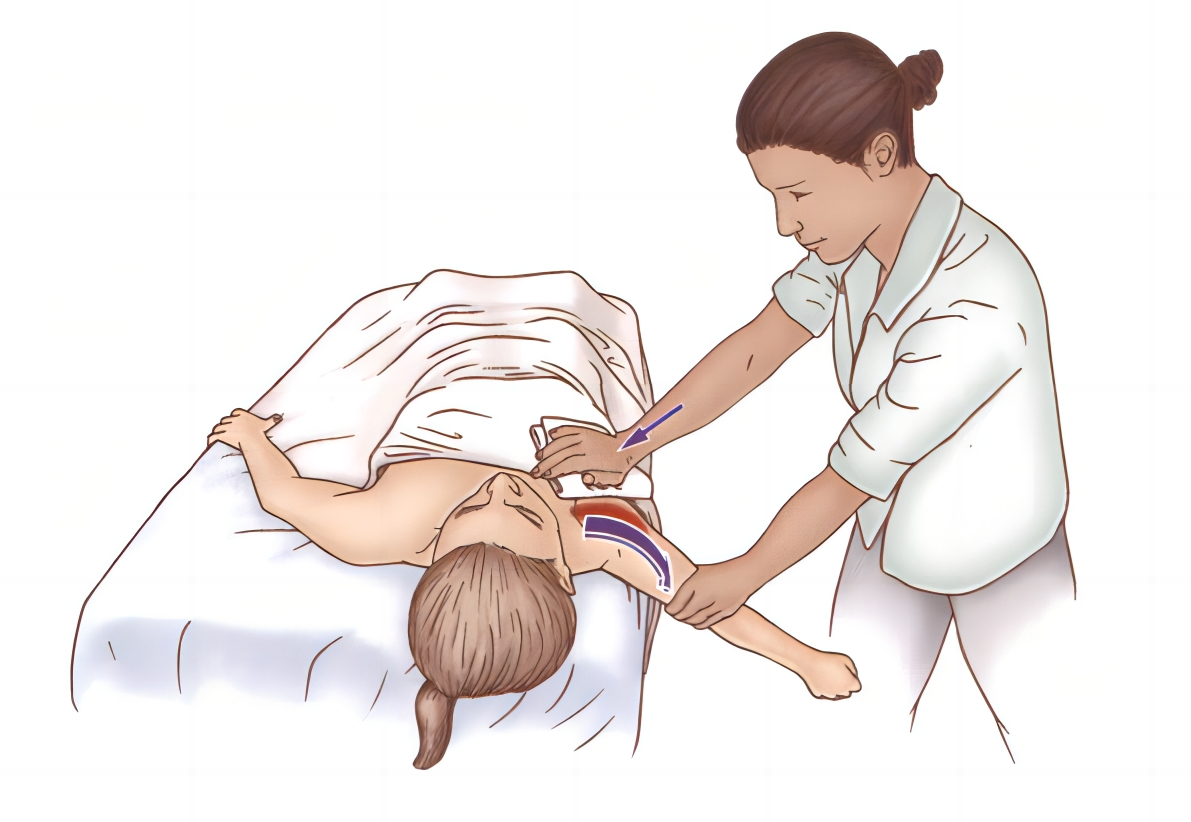 三角肌的松解方法,三角肌手法松解