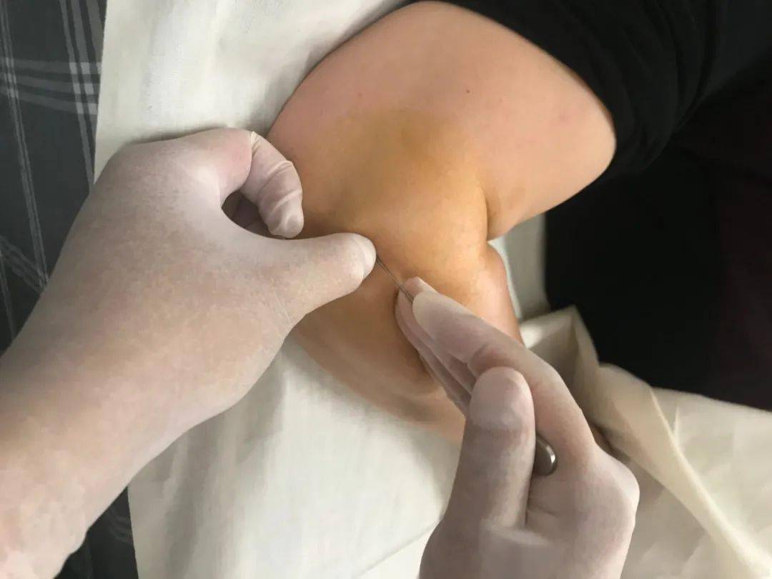 年轻人肩膀痛的治疗方法,整天肩膀酸痛怎么检查病因