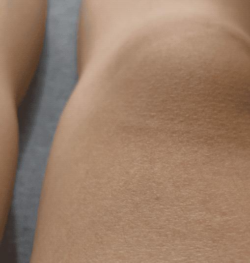 好像腿里有鱼在游还吐泡泡，医生把我捆起来做了一晚监测