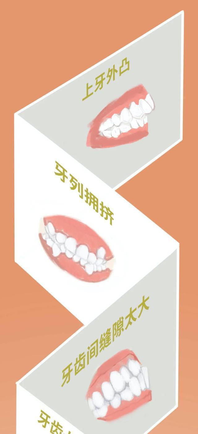 牙套矫正过程漫画,戴牙套是什么体验