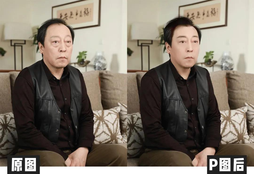 最快的方法帮你淡化泪沟,只需知道一招轻松消除显老泪沟