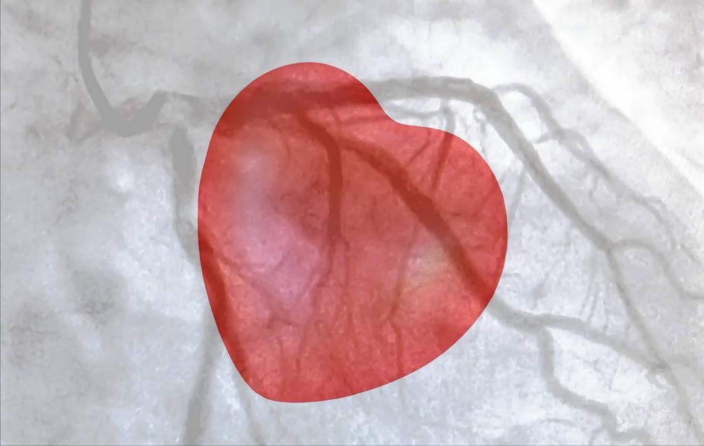 3味中药降血脂扩血管溶血栓,有哪些药可以降甘油三酯血脂