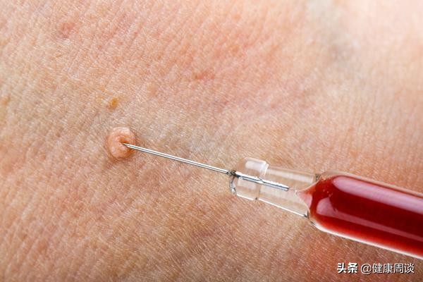 脖子上的小肉球多怎么回事,脖子上的小肉疙瘩是什么原因