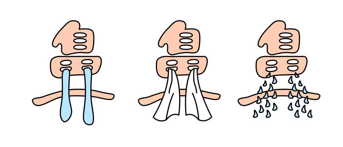 鼻炎腺样体问题去什么科室检查,鼻炎腺样体看什么科