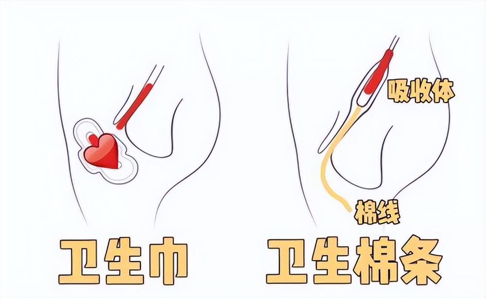 为什么国外喜欢卫生棉条,为什么中国女性还都爱用卫生巾