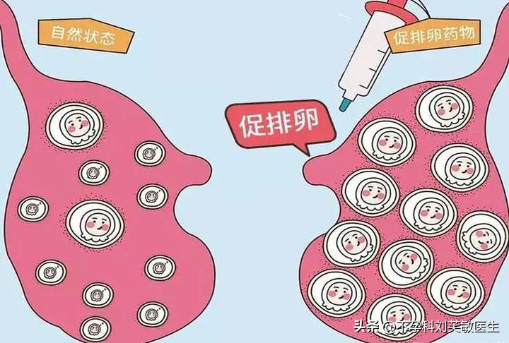 多囊促进卵泡发育的方法,多囊卵巢吃啥药能让卵泡快速生长