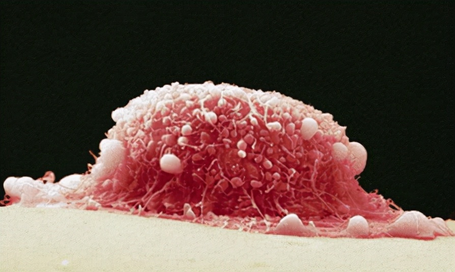 通过性传播的十大疾病都有哪些,通过性传播的病都有哪些