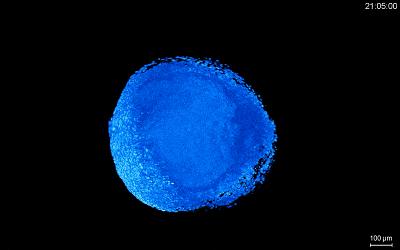 关于疾病预防核心知识的视频,预防精神疾病的健康宣教