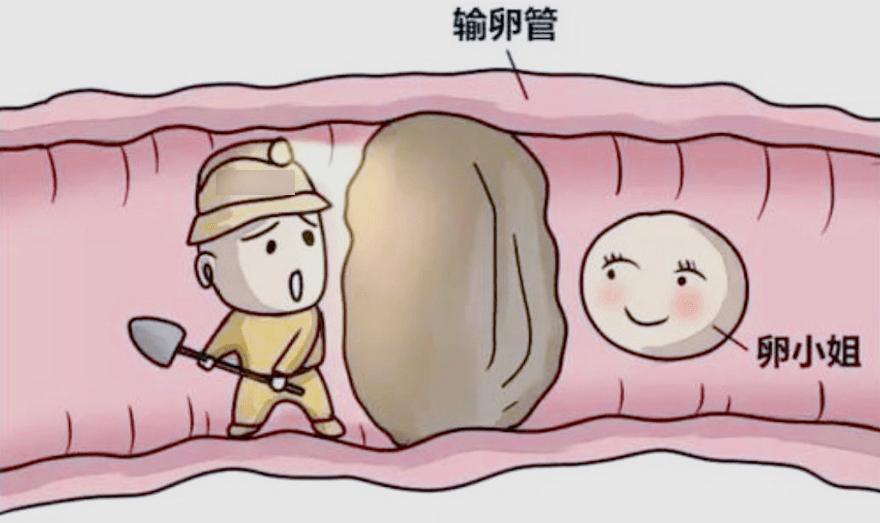 输卵管堵塞做b超能检查出来吗,输卵管造影怎么判断输卵管堵塞