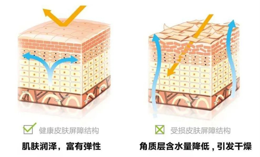 脸颊两边痘痘红肿还反复长痘,反复长痘怎么解决最有效