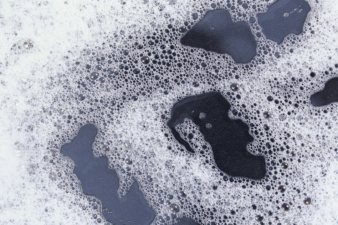 手上沾了502胶水可以用醋解决吗,手上粘着502胶水不及时处理没事吧