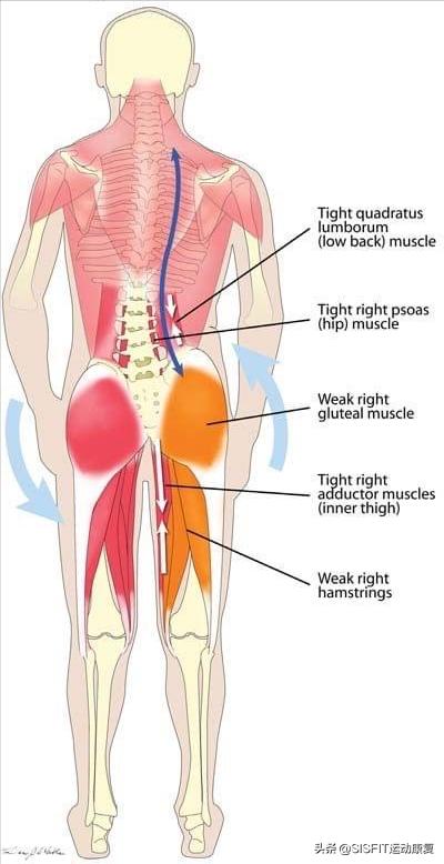 人体各个部位的肌肉最强者,肌肉太发达会导致肌肉型肥胖