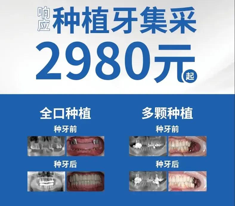 牙疼真要命，种牙更贵得死，浅析牙科行业状况及发展前景