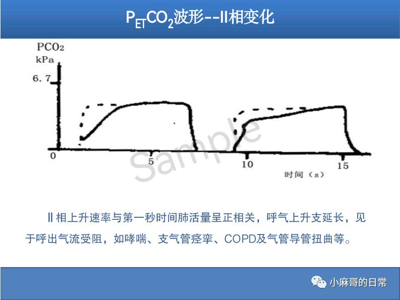 呼气末二氧化碳检测图的解读,呼气末二氧化碳检测操作视频