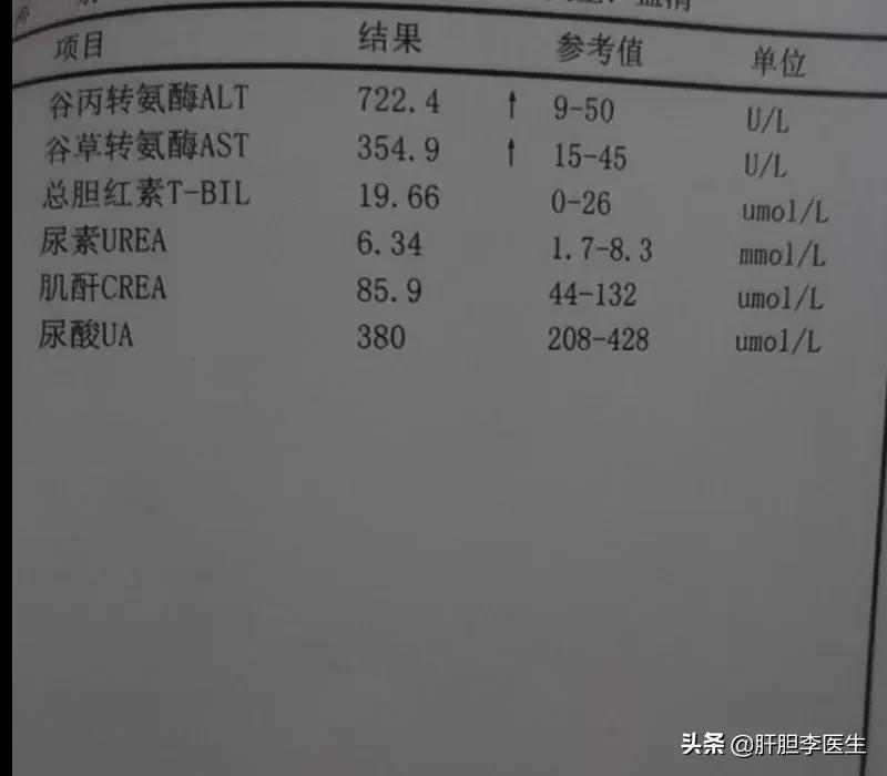 得了乙肝到底会怎么样,得了乙肝就死路一条吗