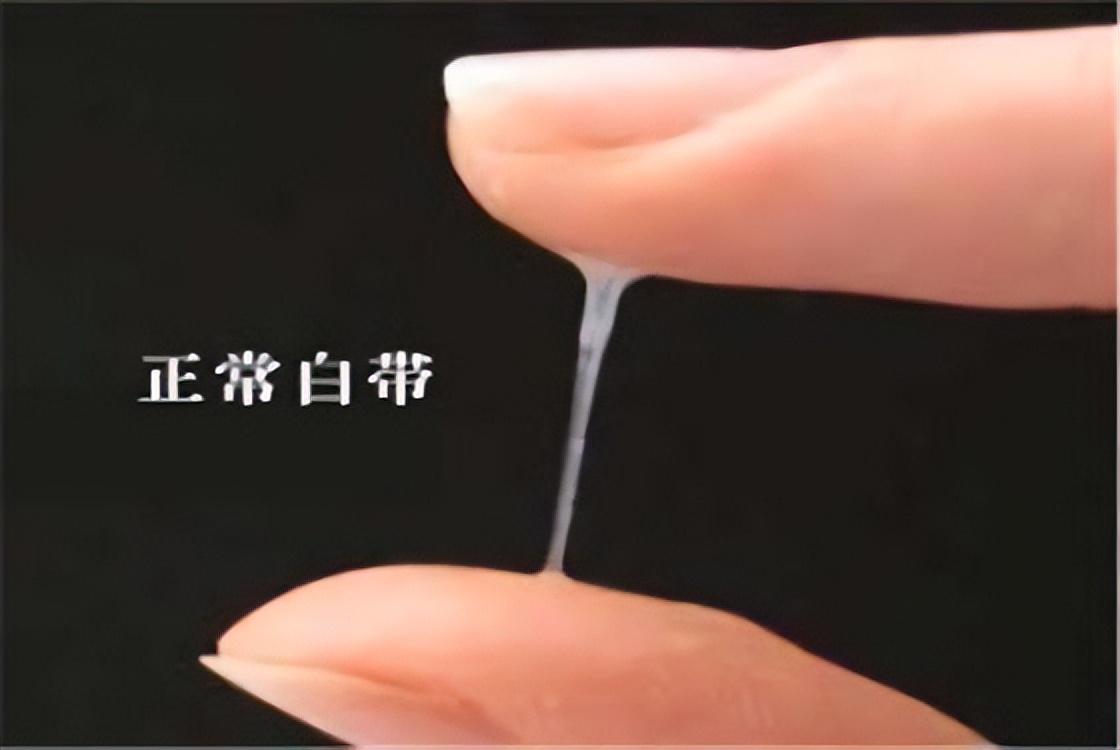 女裤黄黄的是什么原因,女裤上发黄有异味怎么办