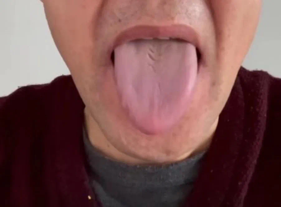 中医怎样治焦虑性失眠,治失眠焦虑有什么中药