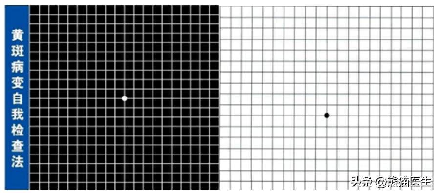 阳了一周之后眼睛模糊是后遗症吗,阳后出现眼部症状会怎样