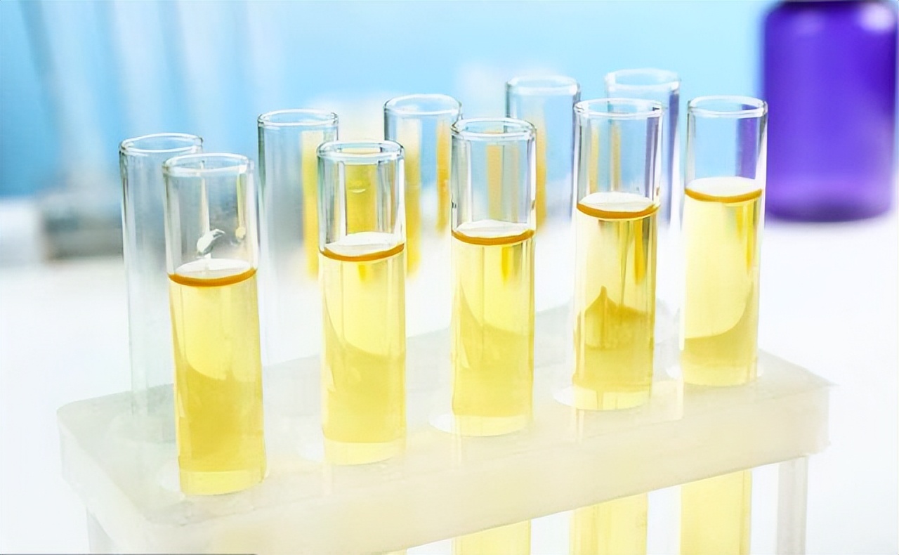 你以为的上火是真的吗,这三种上火症状可能是癌症警报