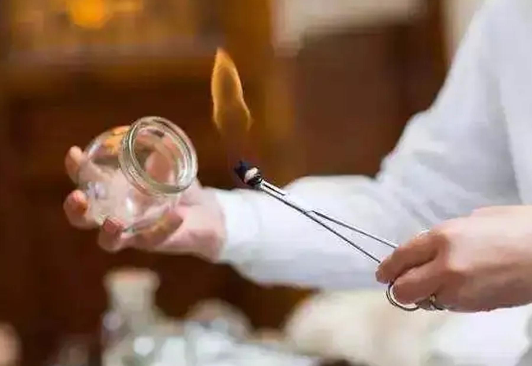 女子拔罐二度烧伤后续,女子拔火罐被烧伤后续