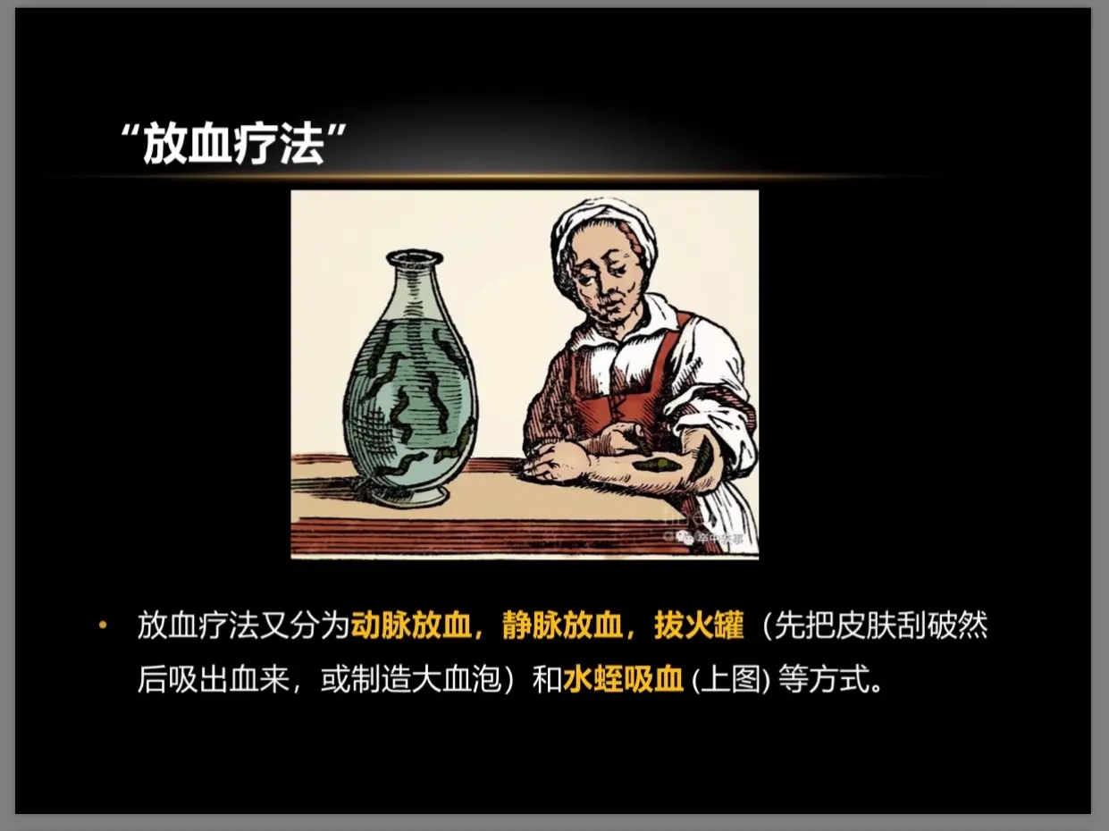中世纪黑暗医疗脑洞大开，放血只是常规，哪里是看病分明是玩命！