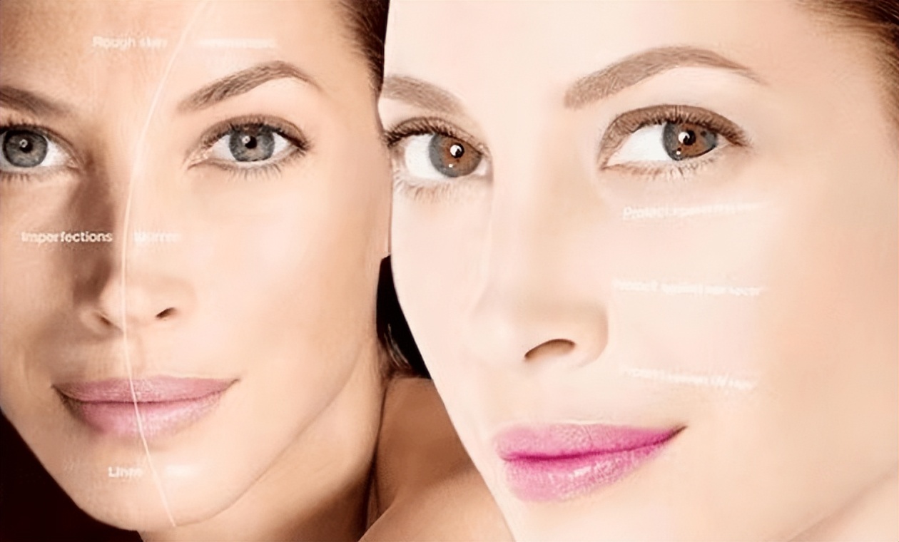 美容超声刀有危险吗,美容版超声刀的坏处